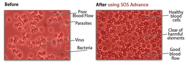 SOS Advance Capsules   
                   ₦ ?70,000